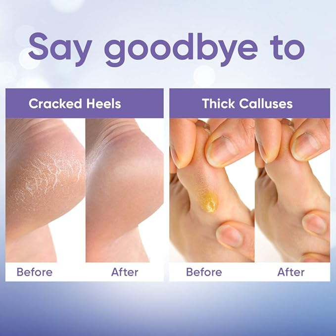 Foot Peel Mask - Foot Mask for Baby Soft Skin - Remove Dead Skin, Dry, Cracked Feet & Callus, Foot Spa, Made with Aloe Vera Extract for Women and Men (2 Pair (Pack of 1), Lavender)