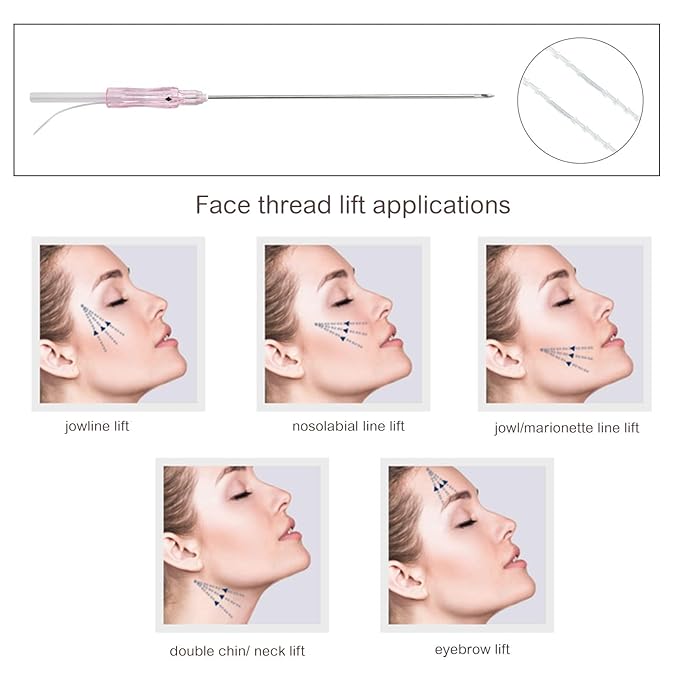 ACADA PCL Cog Threads Face Lift PCL Threads for Face Lift Cog 18G100mm Cog Threads Face Lift 360R Bi-Direction Cog Type Bullet Blunt Cog Threads 20Pcs