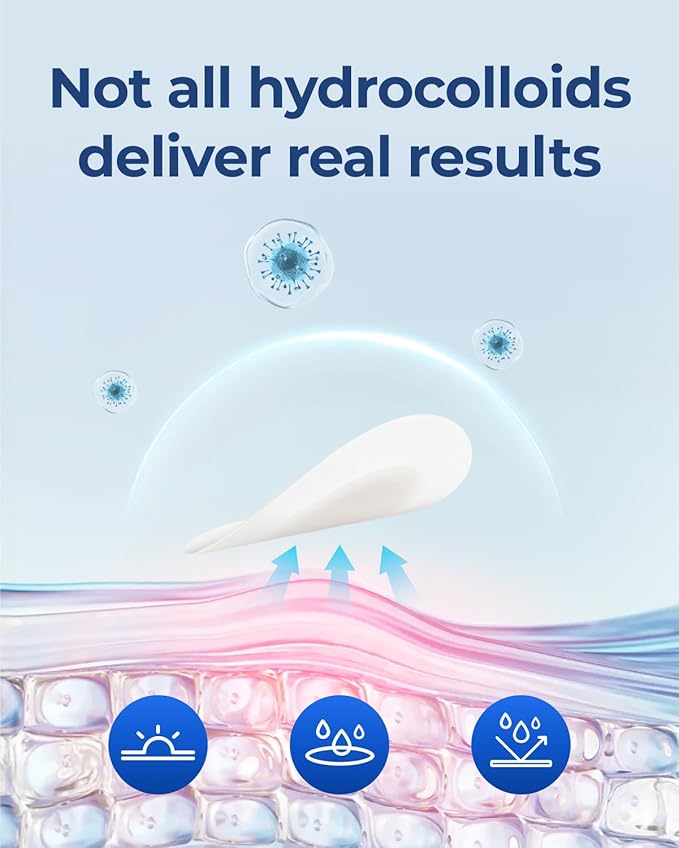 Pimple Patches for Face Acne: Invisible 0.1mm Ultra-Thin Hydrocolloid Zit Stickers with Tea Tree Oil - 308 Dots, 2 Sizes (Whiteheads/Sensitive Skin)