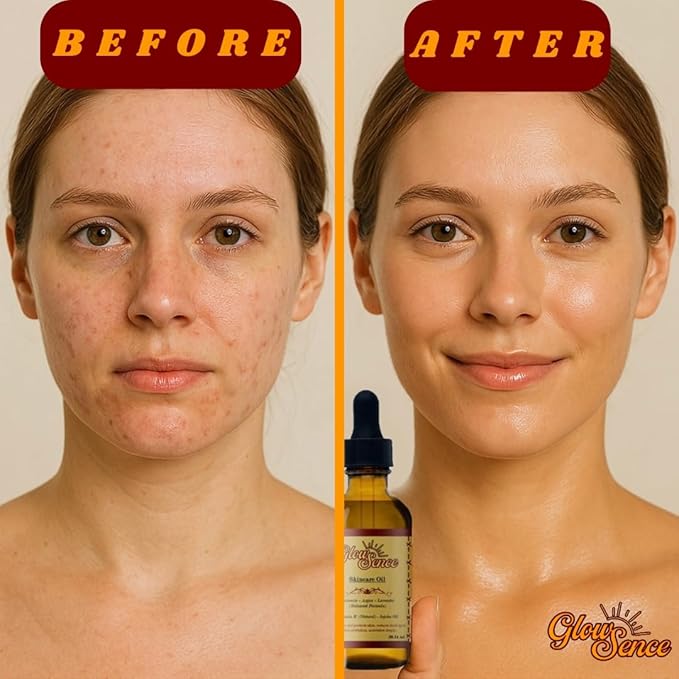 Skincare Oil - Turmeric, Argan, Jojoba, Vitamin E & Roseship - Natural Face & Body for Acne-Prone Skin, Dark spots & Scars - 100% Plant-Based skincare - 2 oz