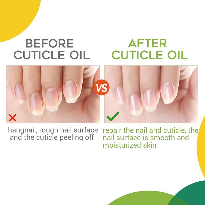 modelones Thin Liner Nail art Brushes with Cuticle Oil, 15ml Nail & Cuticle Care Strengthener Oil Vitamin E + B Cuticle Revitalizing Oil for Nail Growth and Gel Nail Polish