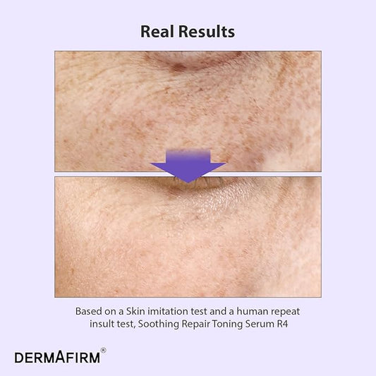 DERMAFIRM Soothing Repair Toning Serum R4 | Korean Bakuchiol Face Serum w/Niacinamide & Peptides | Calming and Correcting Facial Serum | No Animal Trials No Parabens 1.01 fl oz