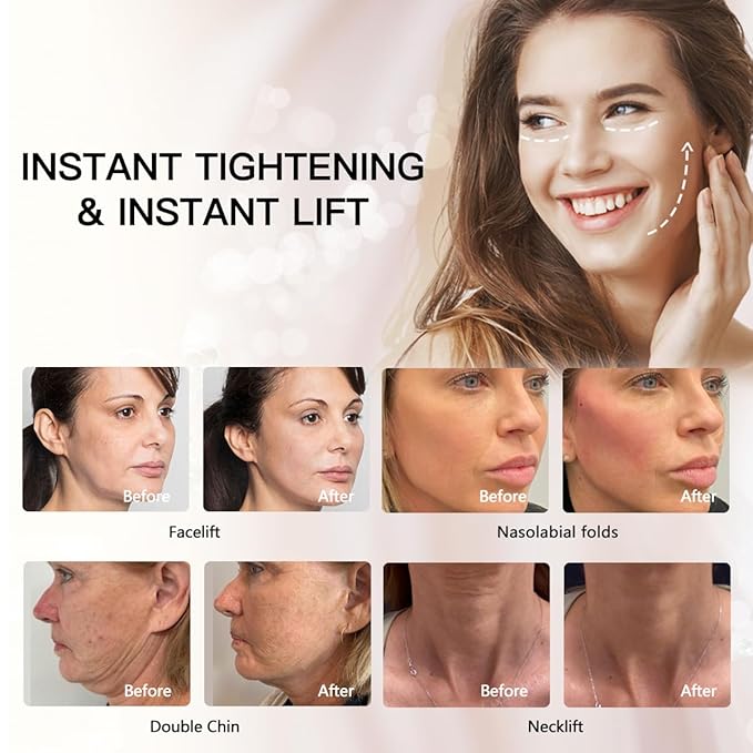 PDO Thread(Mono screw 29G 60MM) Lift/Face Body Lifting/Smooth Mono Screw Type 29G 60mm (50pieces)