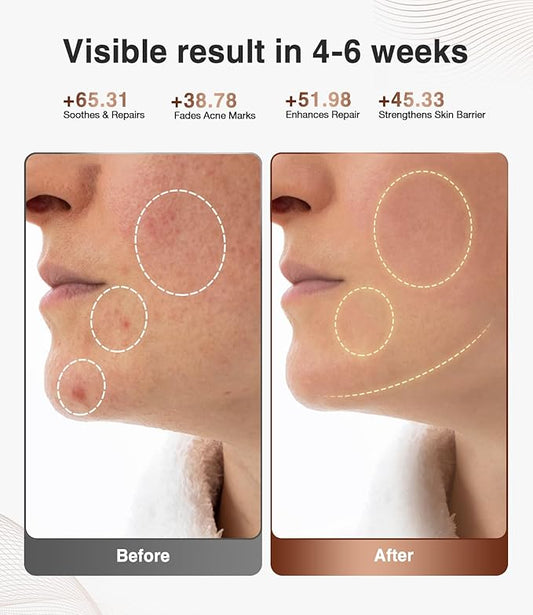 JOVS Red Light Therapy Mask for Face, LED Face Mask Light Therapy with Near-Infrared Red Light, 4 Modes and Portable Skin Care Tools for Home Use