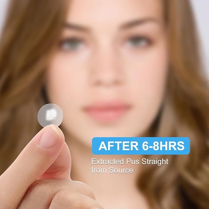 AVJONE Pimple Patches for Face(144 Patches), Hydrocolloid Acne Patches with Tea Tree Oil, pimple stickers for Breakouts, Absorbs Zit, Invisible Spot Cover and Blemish 2 Sizes| Vegan, Cruelty-free