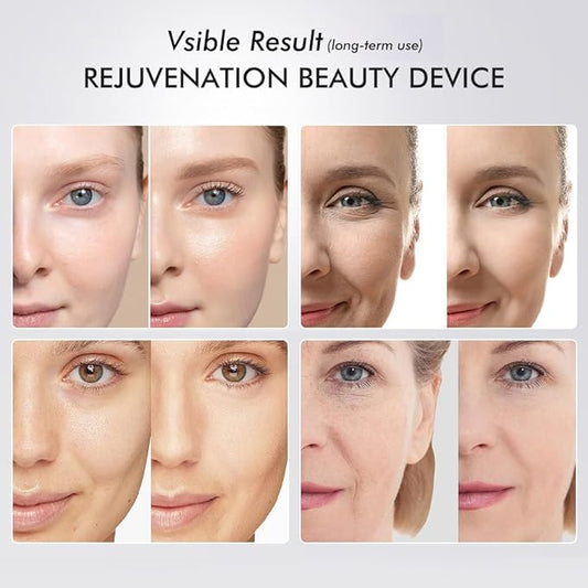 Skin Tightening Face Machine, Face Massager Tool with 5 Modes, Enhanced Absorption, Facial Neck Lifting, Firming and Pore Care