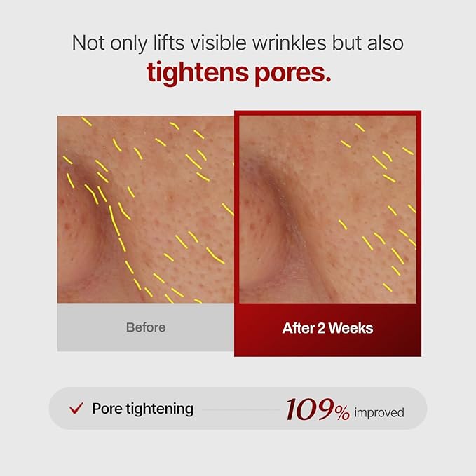 MEDITHERAPY Wrinkle-fit Mask + Facial Roller, Collagen Mask, Lifting Sagging Skin, Hydrating, Improving Elasticity, Glass Skin, Korean Skincare