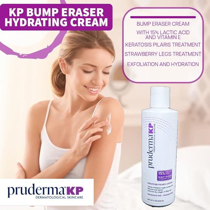 KP Keratosis Pilaris Treatment, KP Bump Eraser Hydrating lotion, Bumps Be Gone, Moisturizing and exfoliating lotion For Rough and Bumpy Dry Skin For Body, 8 Oz