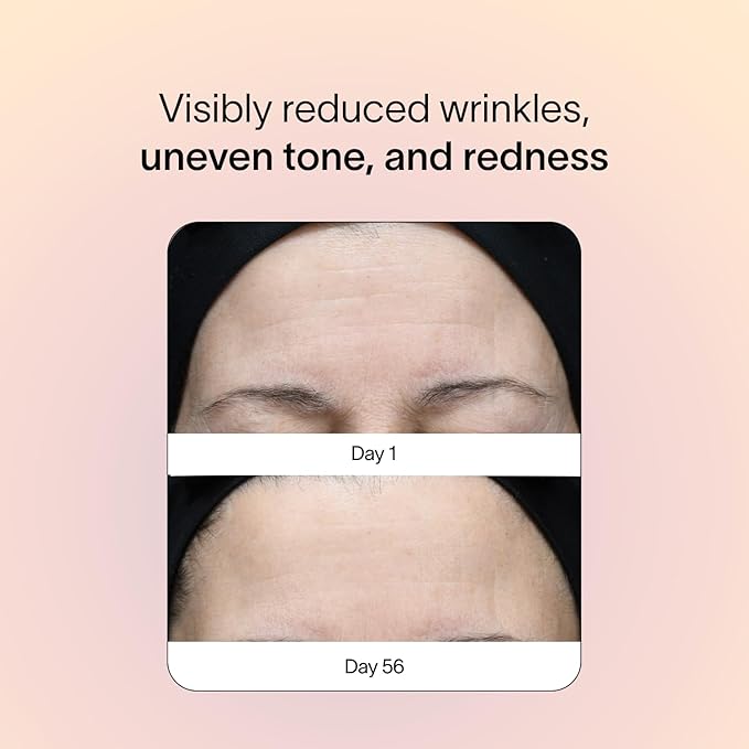 Solawave Red Light Therapy Device for Face & Body | Near Infrared Light Therapy for Rejuvenation | Portable Facial Skincare Solution | Soothes & Depuffs Skin, Reduces Appearance of Lines & Wrinkles