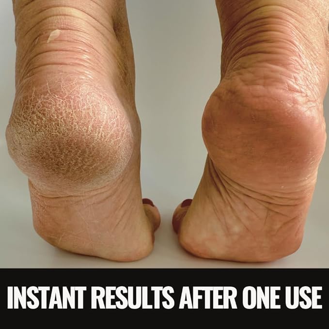 SandBar Heel Revival Regimen – Home Pedicure Kit for Dry, Cracked Feet with Foot File, Foot Scrubber Mat, Sole Soap & Heel Polish – Midnight Rendezvous Scent, Care Set for Women and Men