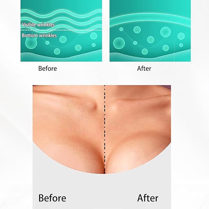 VolksRose Forehead Wrinkle Patches for Anti-wrinkles, Reusable Silicone Patches for Under Eye, Neck and Forehead Wrinkles - Overnight Smoothing Face Tape Mask for forehead Lines wrinkles