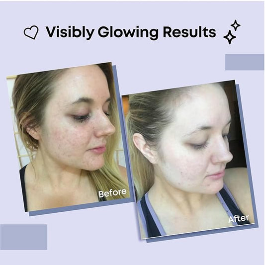 Collagen Face Mask | Hydrating Beauty Skincare Face Mask for Glass Skin, Revitalizing Overnight Collagen Facial Mask for Wrinkles, Selfcare Sheet, Moisturizing Facial Skin Care Product for Women & Men