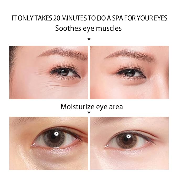 BLUE LOVE 80PCS Calendula Under Eye Patches - Rejuvenating Eye Mask for Reducing Puffiness, Dark Circles, and Wrinkles - Hydrating Treatment for Tired Eyes