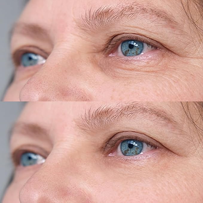 Retinol Eye Cream for Dark Circles & Wrinkles - Advanced Night Repair Treatment with Hyaluronic Acid & Vitamin E | Reduces Puffiness, Fine Lines & Eye Bags | Dermatologist Tested (15ml)