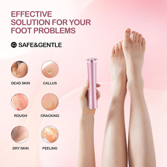 Cordless Electric Foot Callus Remover,Rechargeable Grinder Tool for Feet Dead Skin,Professional Pedicure File Heel Sander with 60pcs Replacement Sandpaper Pads(Pink)