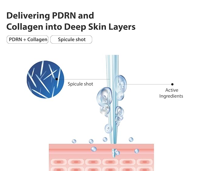 PDRN + BIOME Microshot 100 Serum, Intensive Glow Essence, Microneedling, PDRN, Biome, Spicule, Hydrating, Moisturizing, Firming, Fine Lines, Korean Skincare 1.01 fl. Oz.(30ml)