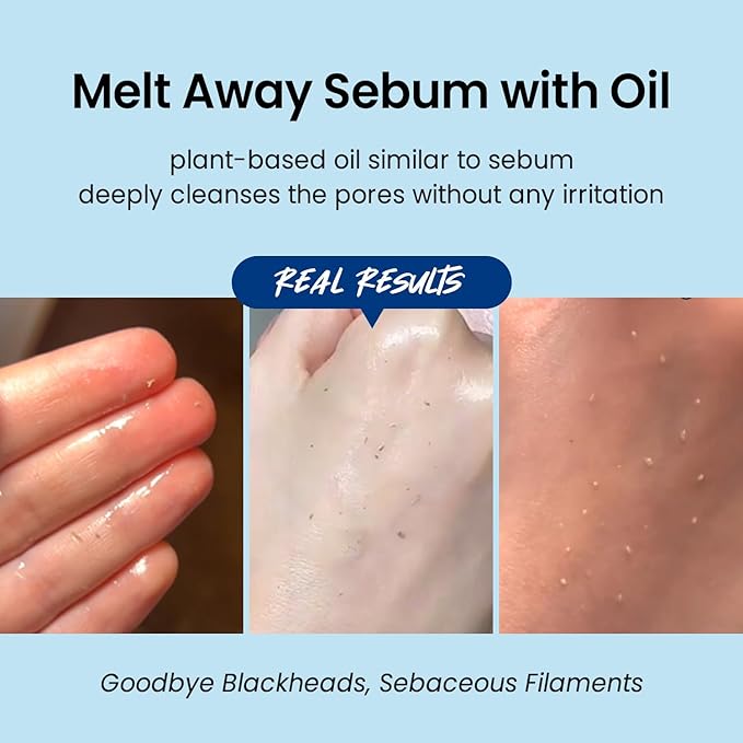 coxir ULTRA HYALURONIC CLEANSING OIL 150ml VITA C EYE CREAM 30ml