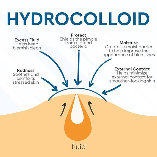 Invisible Pimple Patches (324 Count) - Hydrocolloid Acne Spot Treatment - Zit Patches for Face - Acne Treatment for Face - S/L Sizes