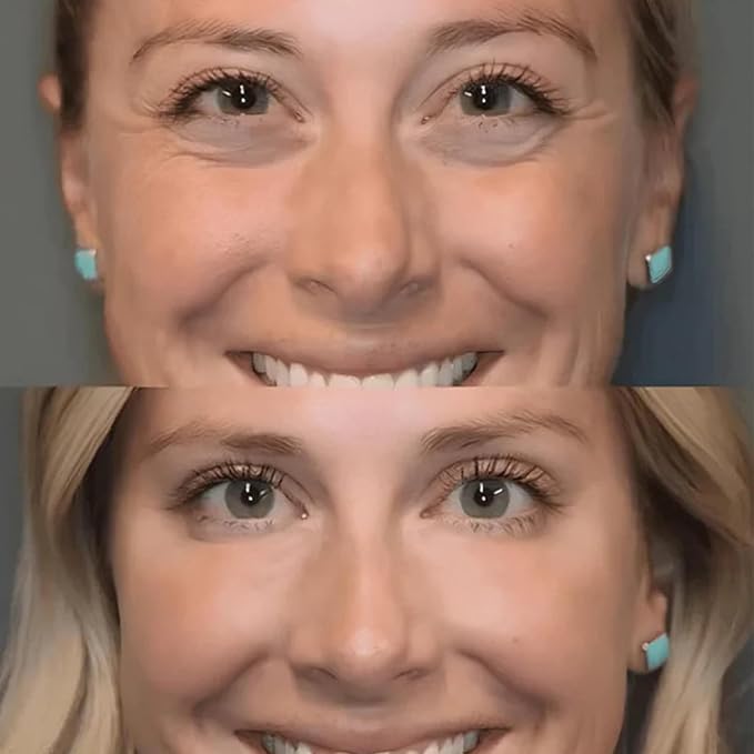 Instant Eye Tightener Cream,Under Eye Tightening Cream for Firm and Smooth the Look of Fine Lines,Reduces Dark Circles, Bags, Puffiness and Fine Lines,Instant Firm Face Tightener(30ml)