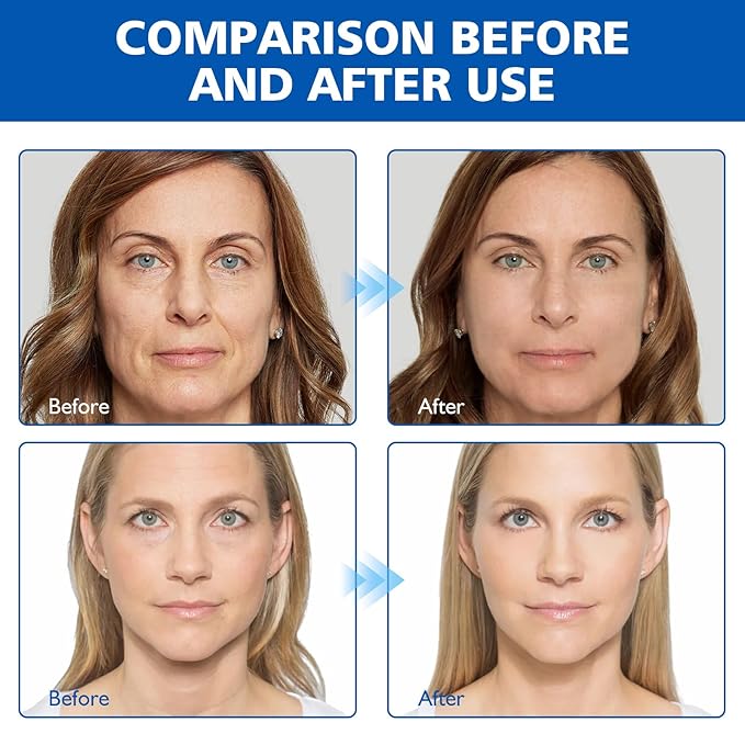 West Month Firming Facial Serum, Skincare Stock Solution, Stock Solution Facial Serum, Reduce Fine Lines Skin-Smooth Looking Skin, Deep Wrinkle Repair Serum, Suitable for All Skin Types(1PC)