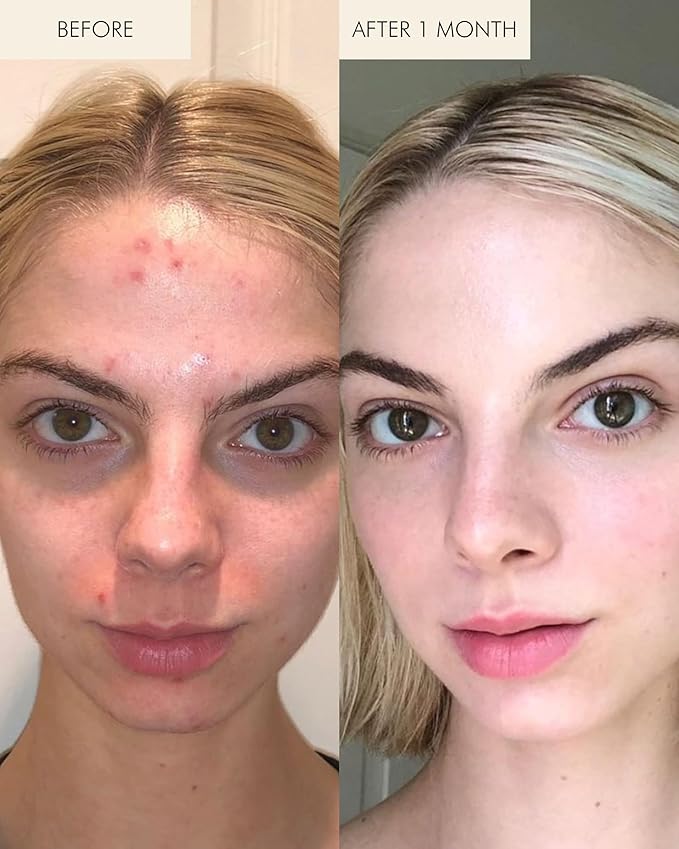 MARA - Natural Evening Primrose + Green Tea Algae Retinol Face Oil | Plant-Based Skin Care | Moisturizes + Soothes Skin To Minimizes Look of Pores + Fine Lines (Travel Size, 0.5 fl oz | 15 mL)