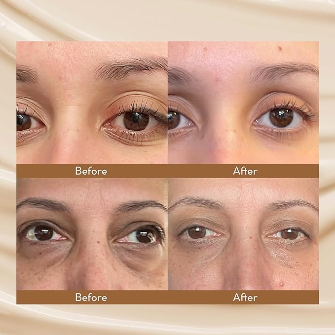 Caffeine Eye Cream for Dark Circles: Under Eye Serum for Puffiness Bags Wrinkles Fine Lines - Anti Aging Firming Tightening 0.5oz/15g