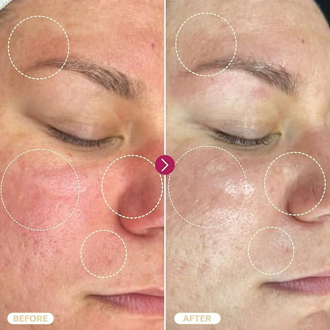 BASE LABORATORIES Hypochlorous Acid Spray for Face & Skin | 8oz | Magic Facial Spray Daily Skin Repair Solution for Sensitive Skin, Redness, Irritations, Eczema | Hypochlrous HOCL Molecule Spray | 2PK