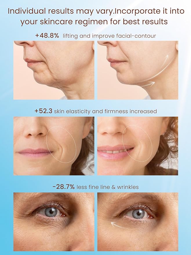 Radio Frequency Skin Tightening Device, Smart Electric Zinc Alloy Facial Beauty Machine with RF-Current Cold Heat for Jawline Lifting, Cheek Firm, Wrinkle Reduction, Depuff, Increase Absorption