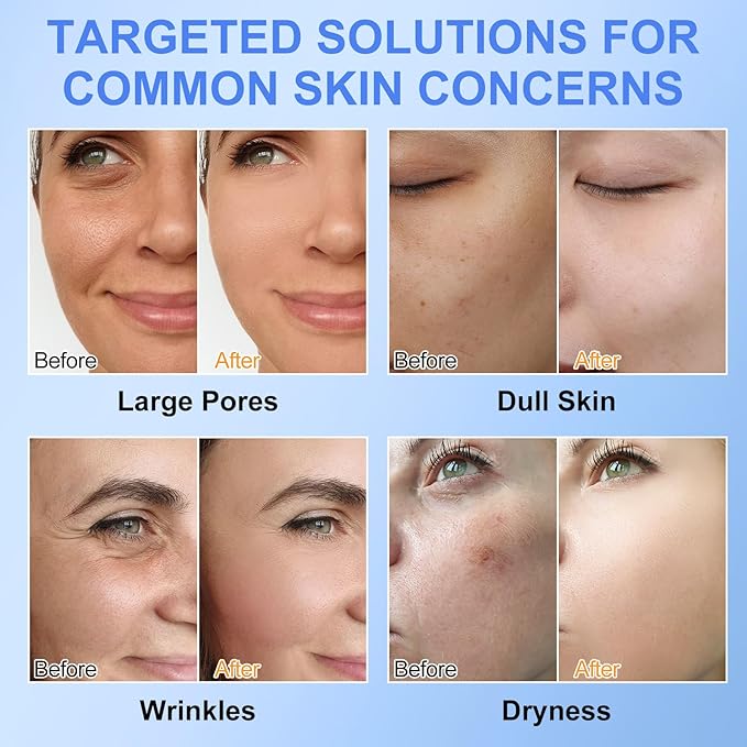 Collagen Face Mask 6P, Collagen Hydrogel Mask, Moisturize, Firm & Enhance Skin Vitality, Pore Minimizing, Elasticity Improvement 6 Packs