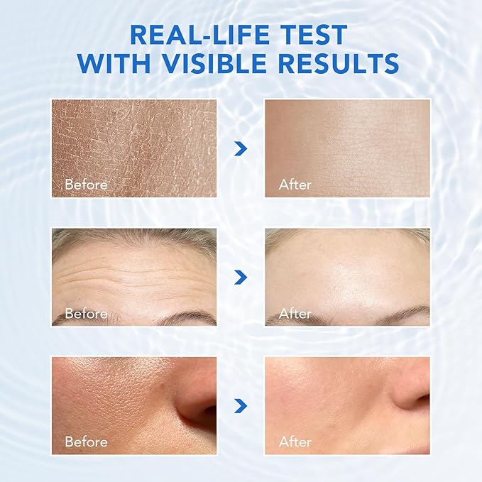 3% Hyaluronic Acid Serum,Hyaluronic Acid for Face, Ultra-Hydrating Vials,Moisturizing,Plumping Skin & Smoothing the Look of Fine Lines,Anti-Aging Serum for Face,Dry&Sensitive Skin(1.2 ml)*30