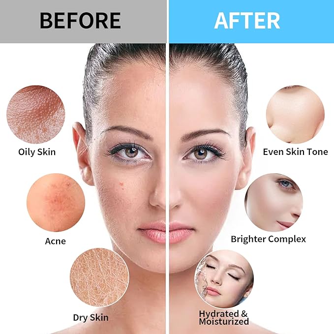 24K Gold & Hyaluronic Acid Jelly Mask, Facial Skin Care- Collagen Peel-Off Jelly Mask Set, For Facials, Face Mask For Instant Hydration, Vegan Peel Off Face Mask, For Hydration