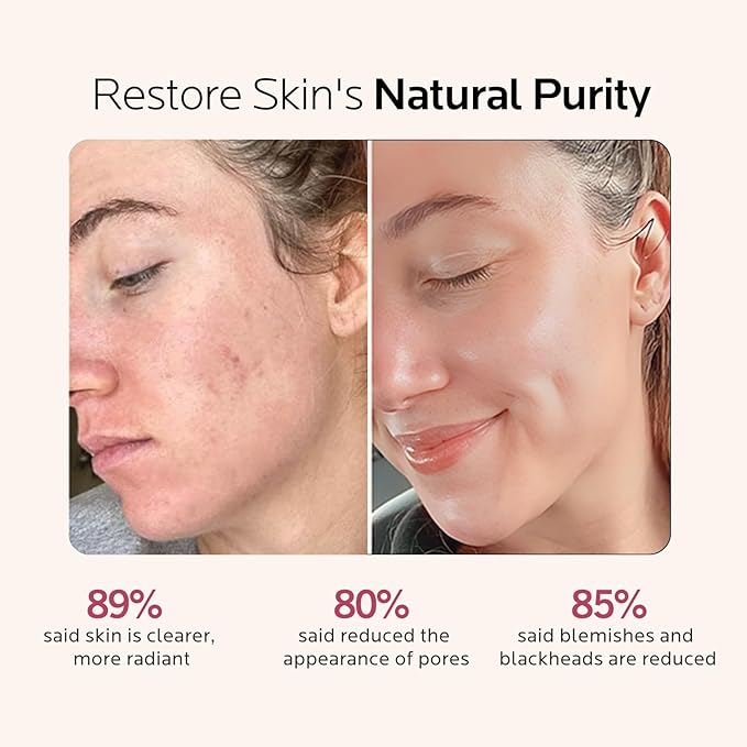 Facial Steamer Self-Care Gift Kit: Nano Ionic Face Steamer Deep Cleaning Unclogs Pores - Humidifier Hot Mist Spa Gifts for Women with 17 Skin Care Tools (Ageless Radiance Spa Kit)