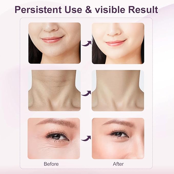 Facial and Neck Massager,7 Color LED Light Therapy for Face,Face Lift Device,Beauty Face Massager Tools for Skin Care (White)