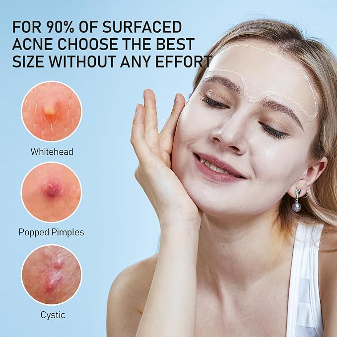 Large Pimple Patches for Face, Hydrocolloid Acne Patches, Zit Patches for Large Troubled Face, Chin, Back Blemish Patches Acne Spot Treatment Blemish Patches Pimple Stickers