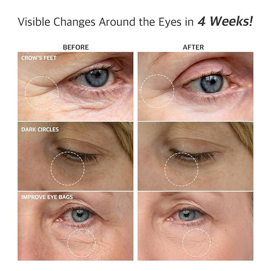 Snail Repair Eye Cream 1.69 fl oz – Hydrating Eye Treatment with Snail Mucin and Niacinamide for Fine Lines, Puffy Eyes, and Dark Circles – Korean Skincare for a Smoother, Radiant Look