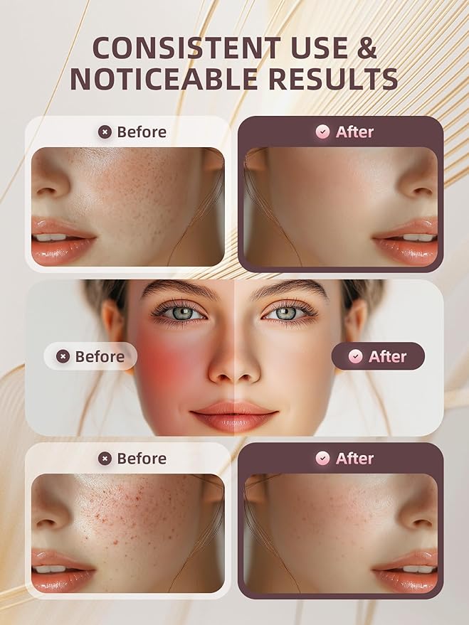 Multifunctional Facial Massager, Real Glass Glow Device for Face and Neck, Portable Face Massager Tool for Skin Care Pore Care, Enhanced Skin Radiance Effective Against Dullness