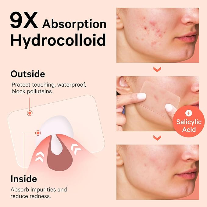 Sosky Large Pimple Patches XL Hydrocolloid Acne Patches for Face & Body Cystic Pimple & Zit Patch for Nose Chin Back, Bacne & Breakouts Vegan Cruelty-Free（8 Count）