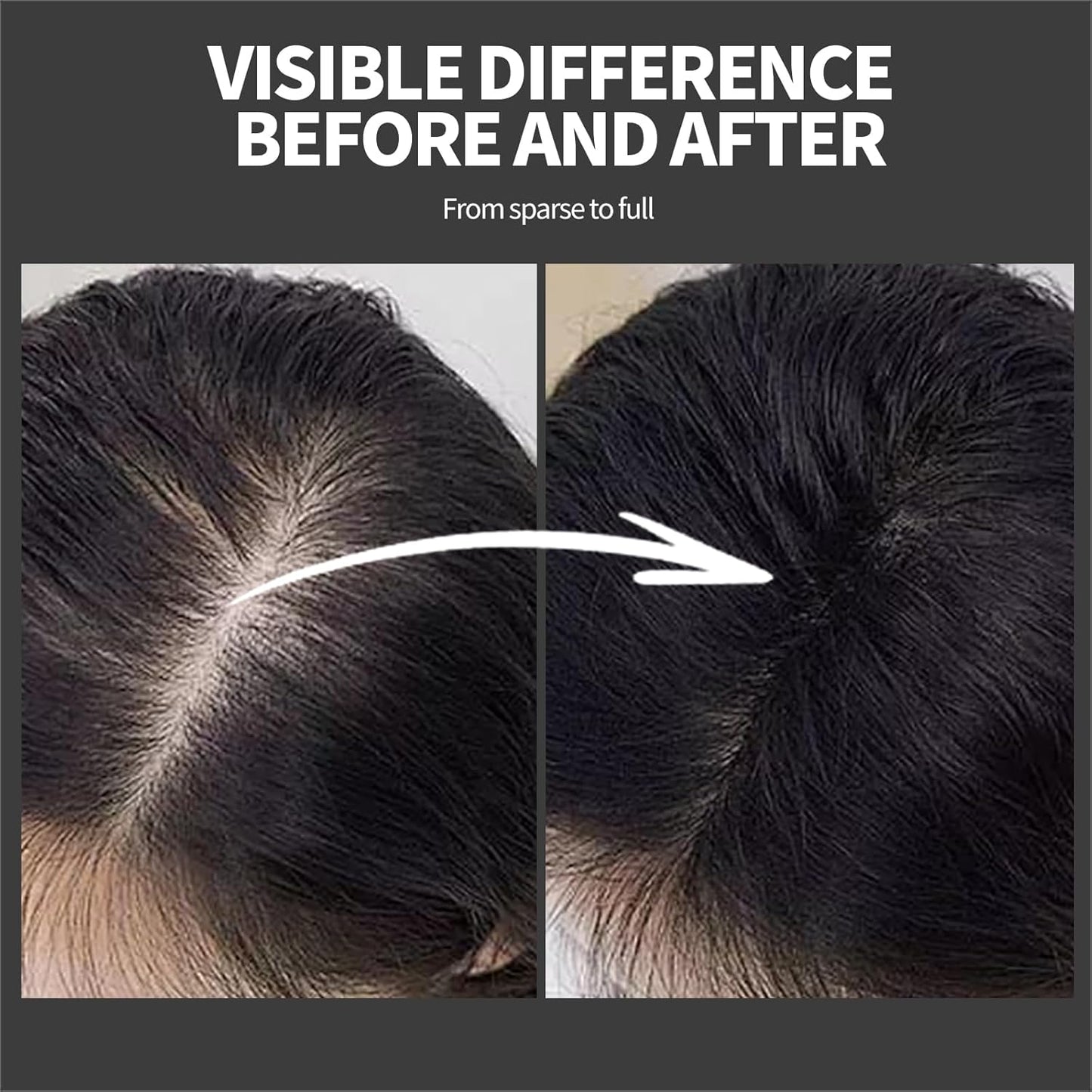 Hair Building Fibers 25G with Precision Spray Applicator - Electrostatic Adsorption for Instant Thicker Hair, Waterproof & Natural Look, Suitable for Men & Women (Light brown)