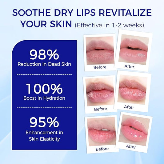 Medicated Lip Balm w/Organic & 100% Natural Ingredients, Squeeze Tube Lip Butter SPF 25+ Long-Lasting Moisturizing Overnight Lip Mask Gentle Exfoliation Extreme Dry Lips Treatment