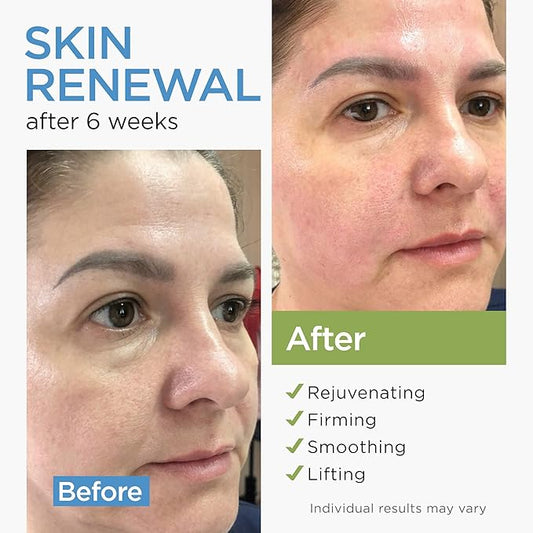 Collagen Face Cream with Stem Cells Retinol Hyaluronic Acid Niacinamide - Anti-Aging Collagen Face Moisturizer with Airless Pump - Day & Night Moisturizer for Wrinkles - Made in USA