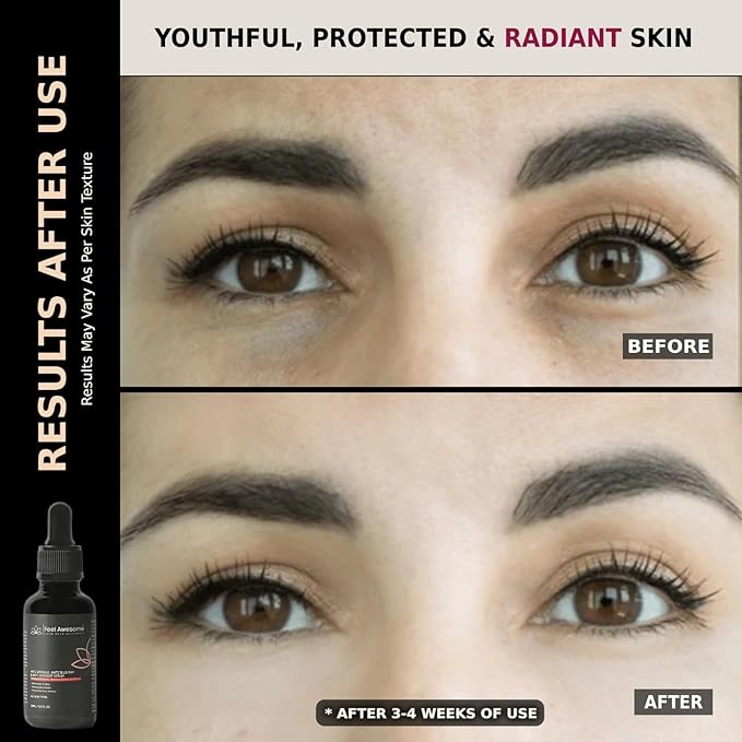 Anti Wrinkle, Anti Blue Ray & Anti Oxidant Serum with Retinol, Niacinamide, Hyaluronic Acid | 3 in One Serum | Hydrates & Smoothens Skin | 1 Fl Oz / 30 ml