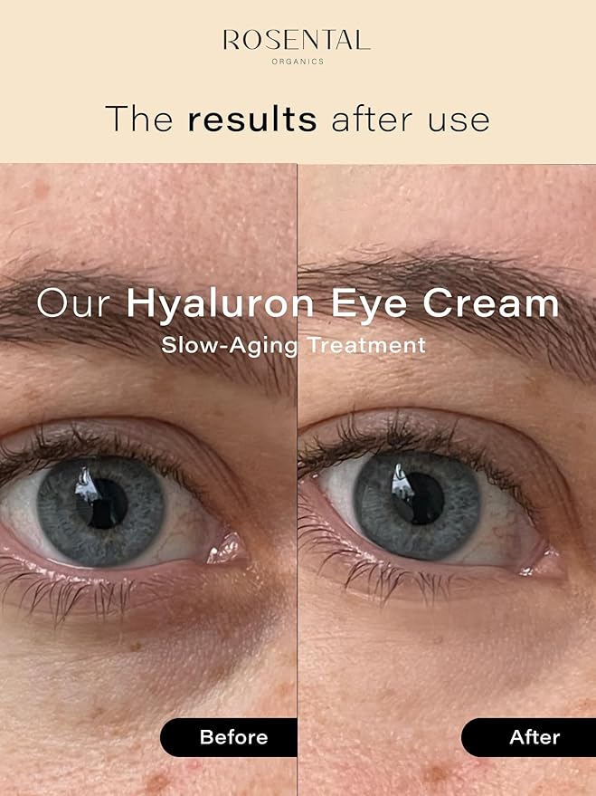 Organics Organic Eye Cream for All Skin Types, 15ml (0.5 fl. oz) (Hyaluron Eye Cream, 15ml)