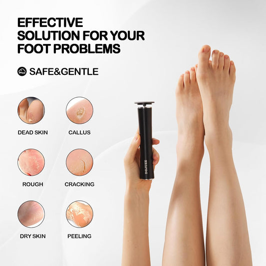 Cordless Electric Foot Callus Remover,Rechargeable Grinder Tool for Feet Dead Skin,Professional Pedicure File Heel Sander Tools with 60pcs Sandpaper Pads(Black)