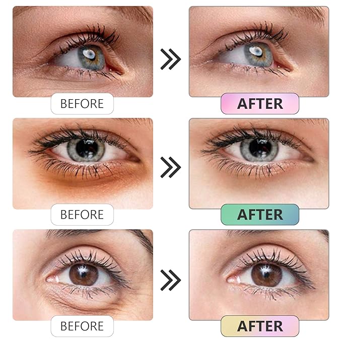 Under Eye Patches -30 Pairs Sakura Essence Eye Mask Eye Pads for Puffy Eyes, Reducing Dark Circles, Anti-Aging, Collagen Eye Mask for Moisturizing, Black