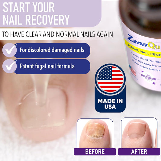 ZanaQuick 2 Step Toenail Fungus Treatment. Extra Strength Damaged Nail Solution & Renewal Drops and Damaged Nail Disruptor – Repair Strategy Kit for Discolored Brittle Nails