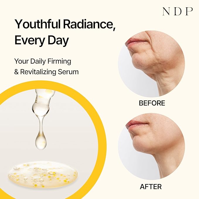 BeBebiome Revitalizing Serum (30ml / 1.01 Fl oz) Vitamin C, Pro-aging, Rejuvenate, Glow Skin, Wrinkle Care, Youth Activating, Kombucha for Face, NDP