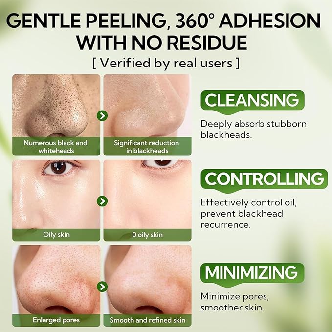 LANBENA Blackhead Remover Nose Pore Strips for Face, 2.0 Upgraded Deep Cleansing Peel off Mask Nose Strips Skincare for All Skin (1.06 Oz/30g) - 60pcs Strips (White+Black)