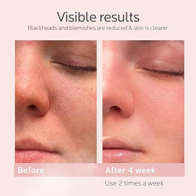 Colorfarm Facial Steamer Skin Care Kit: Face Steamer Home Spa Deep Cleaning Unclogs Pores with 6 Skin Care Tools - Relaxing Self Care Skincare Beauty Gifts for Women Girl (Pore Purifier Pro Kit)