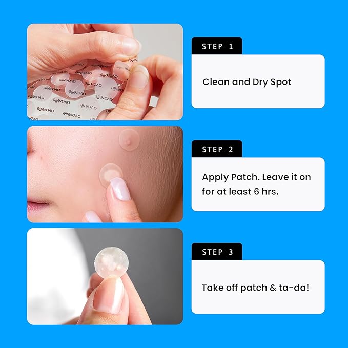 AVARELLE Pimple Patches for Face | Hydrocolloid Acne Patches for Covering Blemishes | FSA HSA Zit Patches with Tea Tree, Calendula, & Cica | HSA Store Eligible Items (10-14 mm, 80 Count)