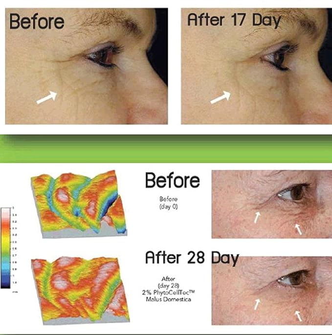 Anti-Aging. DIY Swiss Apple Stem Cell 100% Serum Booster. Remove Wrinkles, Rebuild Collagen & Elastin